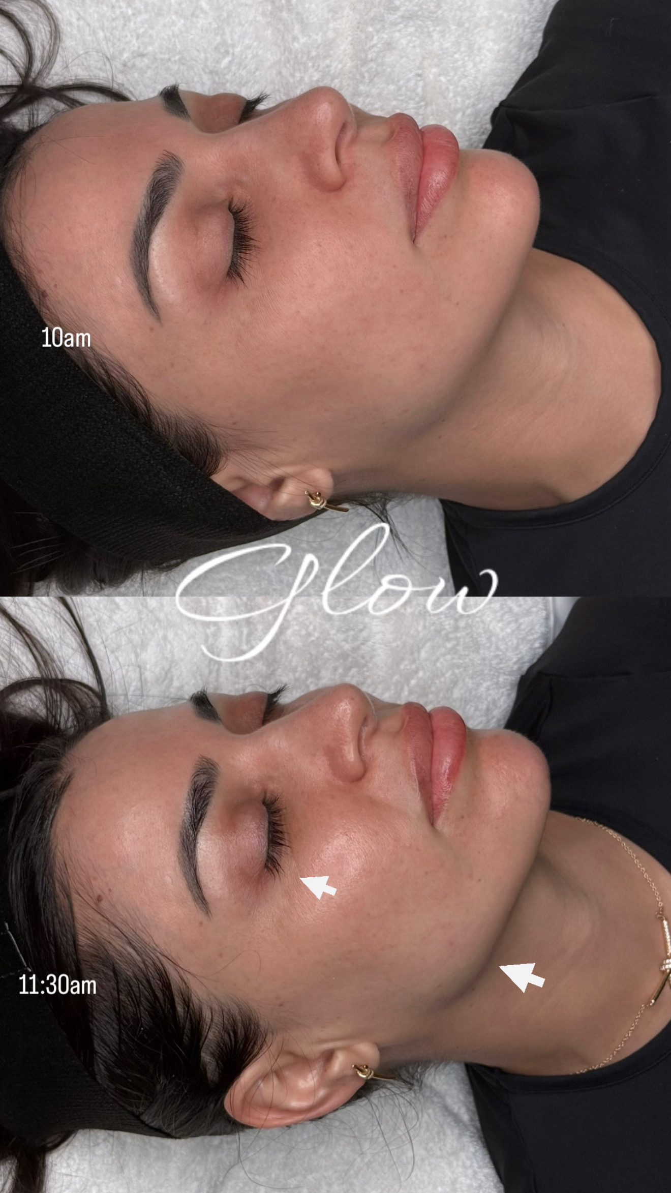 Side view of a woman's face before and after skincare, showing improved skin glow, with timestamps 10am and 11:30am.