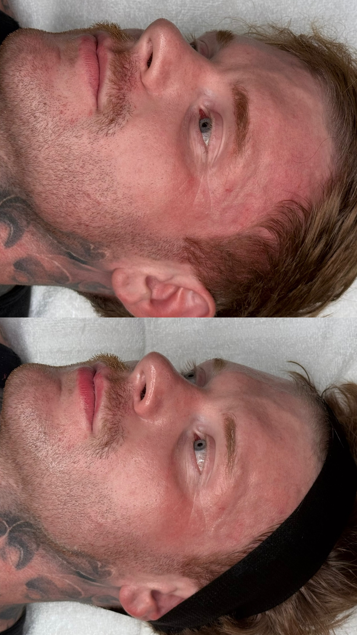 Side view of a man's face with light skin, short brown hair, and tattoos, lying down with eyes open.